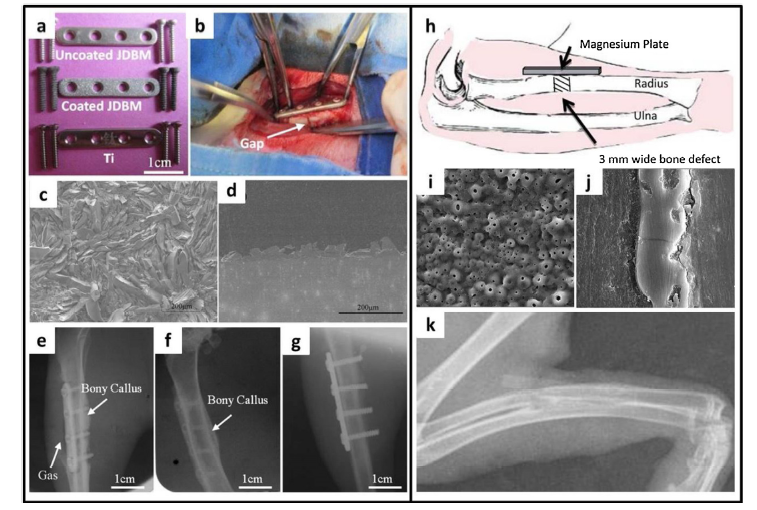 elements of fracture fixation pdf free download